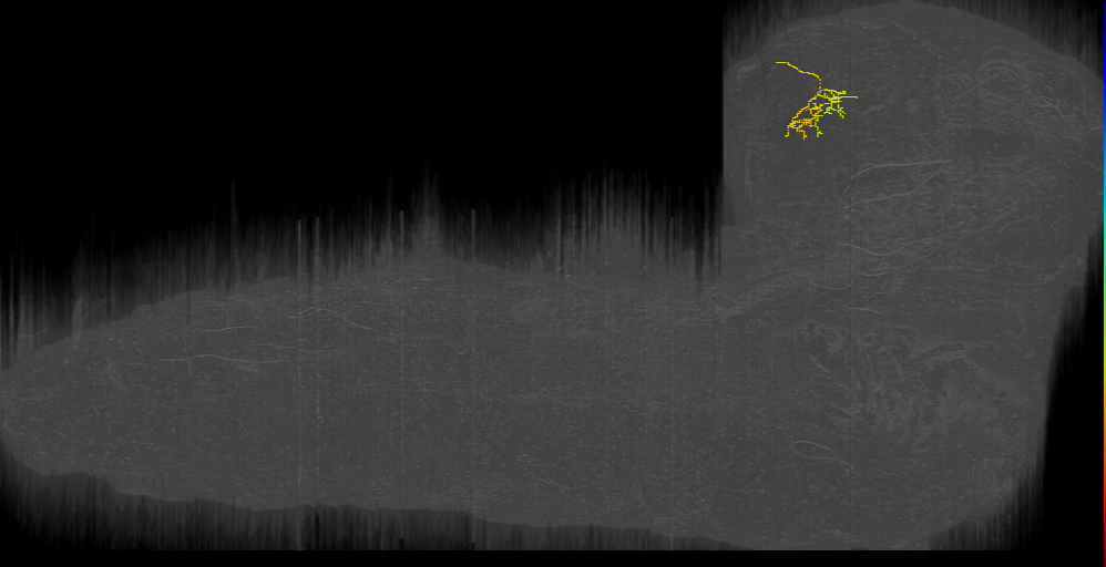 AF3 left (L1EM:17244655)