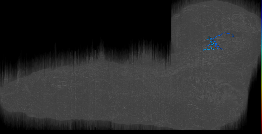 neu1_right (L1EM:17247877)