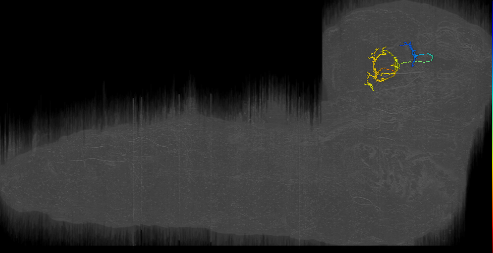 MB2IN-161 (L1EM:17354392)