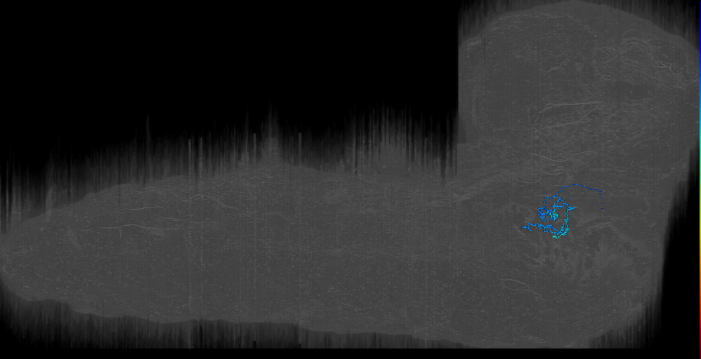 BAla34 descending right (L1EM:17355892)