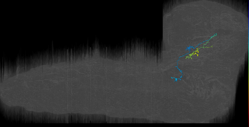 BAmd2 contralateral descending 2 left (L1EM:17358864)