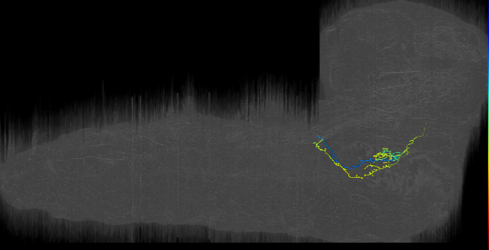 BAmas12 midline neuron 2 left (L1EM:17359101)