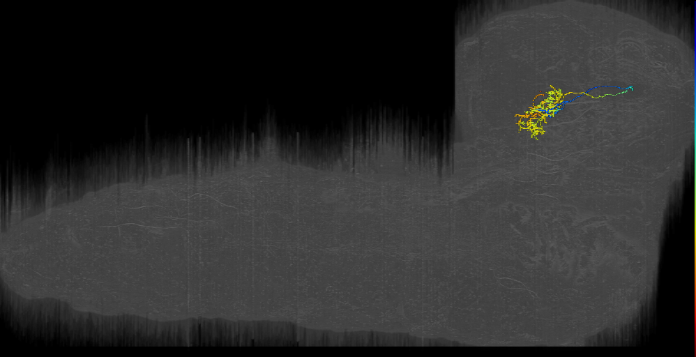 DPlal outer bilateral 1 left (L1EM:17360038)