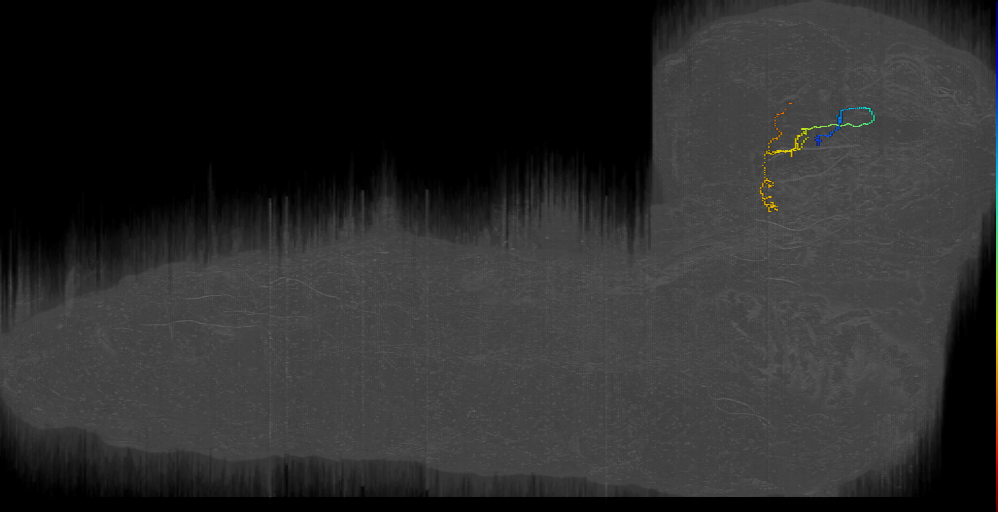 MB2IN-141 (L1EM:17360076)