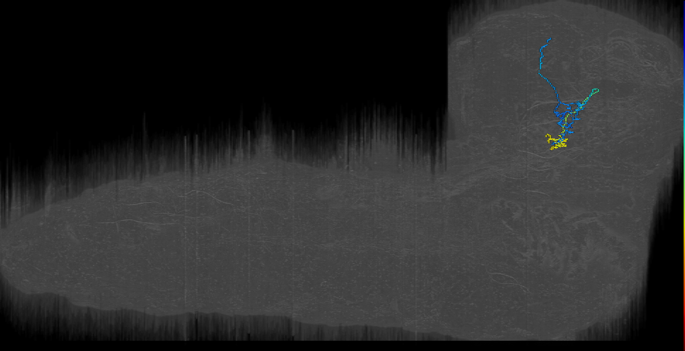 ni contralateral 1 right (L1EM:17435815)