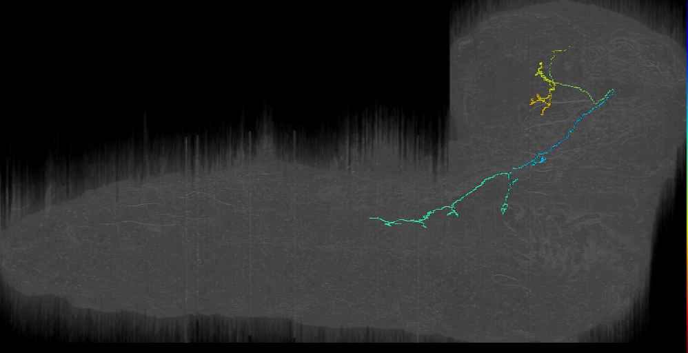 DPMl contralateral descending left (L1EM:17473163)