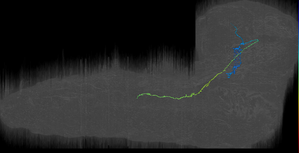 UNK descending contralateral right (L1EM:17589475)