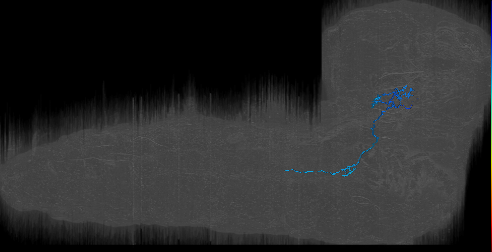UNK descending 1 right (L1EM:17654514)