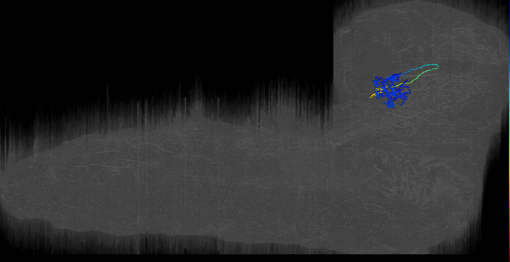 MIXED bilateral 2 right (L1EM:17654624)