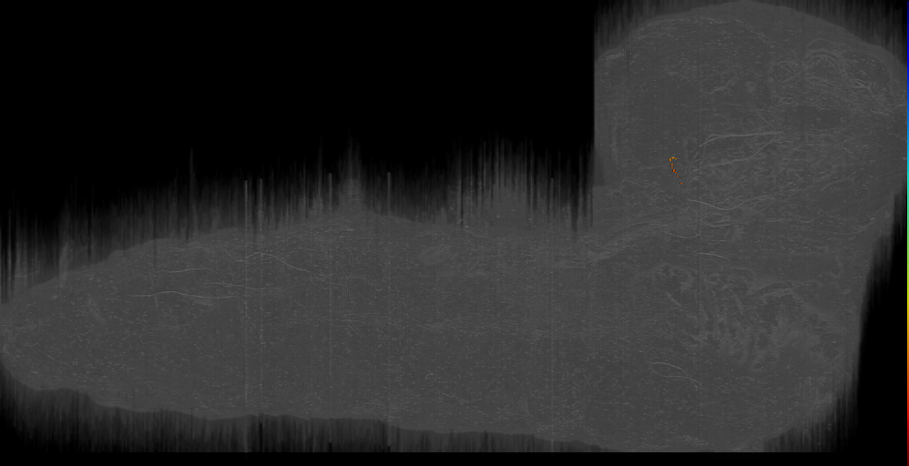 only soma 17729029 (L1EM:17729029)