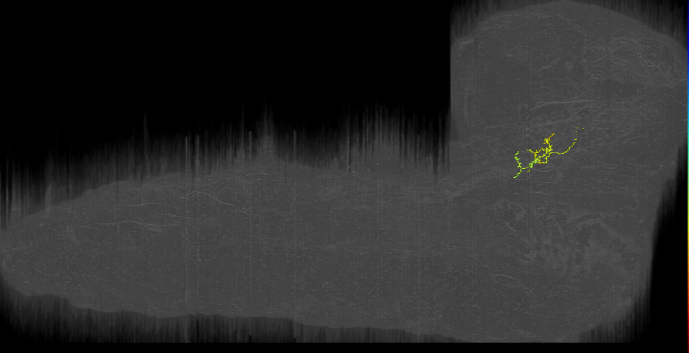 UNK3 descending left (L1EM:17736641)
