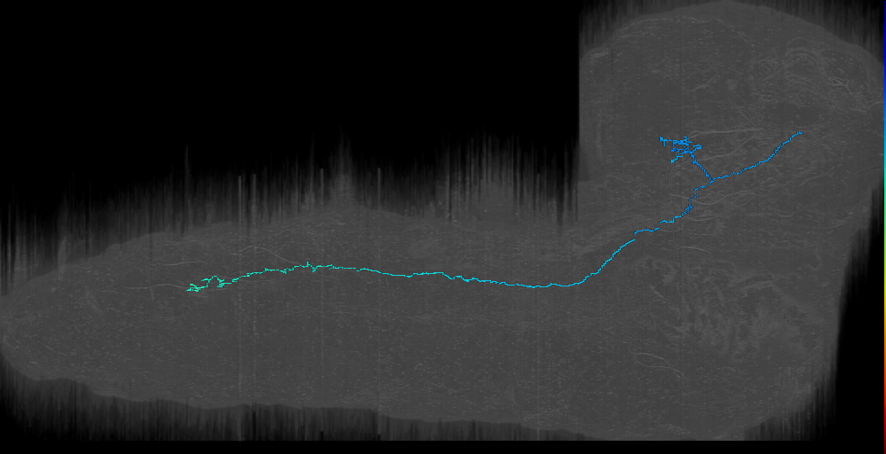 BAmd2 descending 1 right (L1EM:17877682)