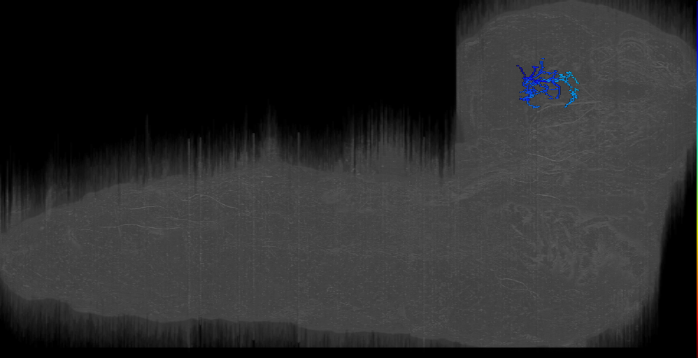 LH_sibling 67 right (L1EM:17942676)
