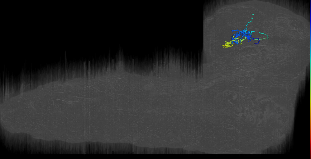 PDM1 right (L1EM:17952967)