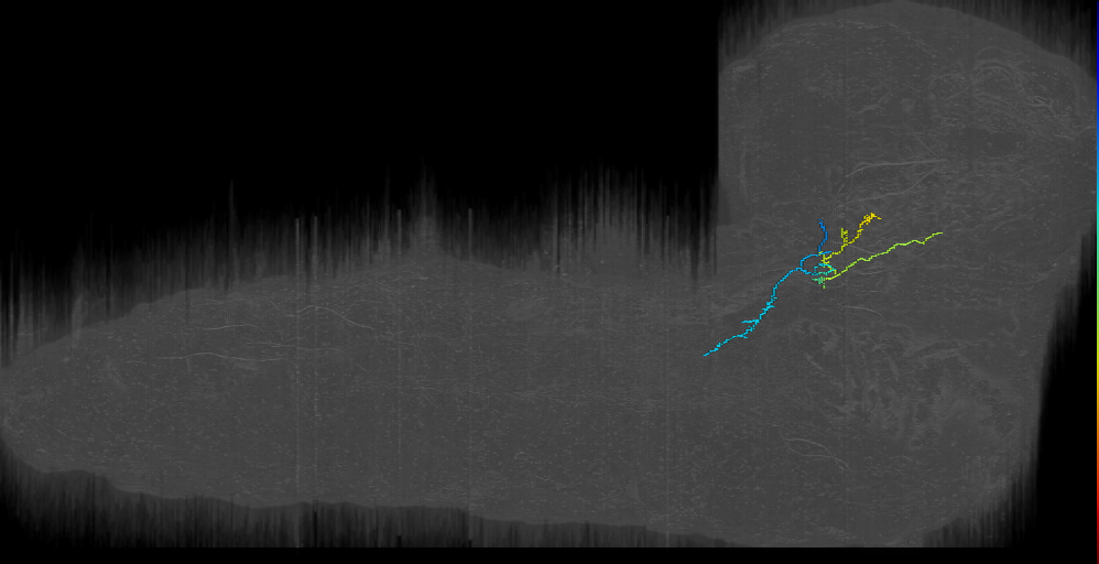 BAmv12 contralateral 2 left (L1EM:18695745)