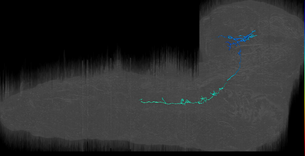 CPf descending ipsilateral right (L1EM:19010160)