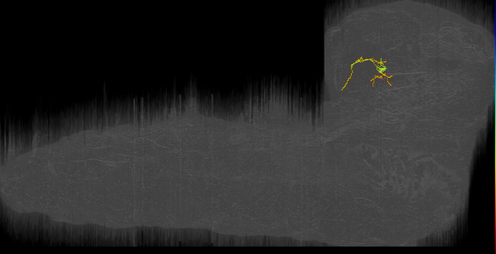 BLP34 interneuron X left (L1EM:19051631)