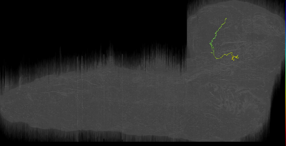 UNK posterior hook left (L1EM:19835787)