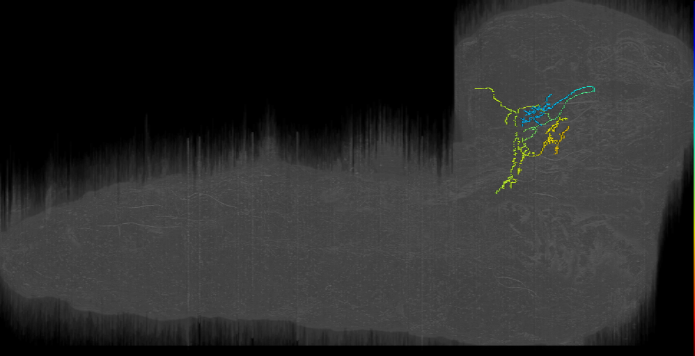 CP contralateral left (L1EM:19881737)