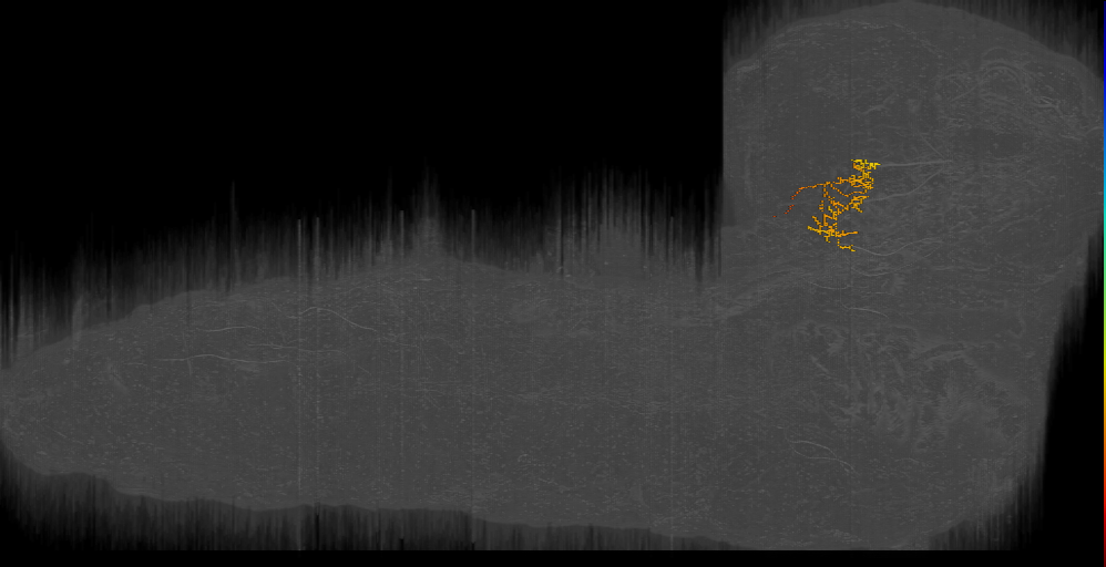 MIXED pointer-like left (L1EM:20981306)