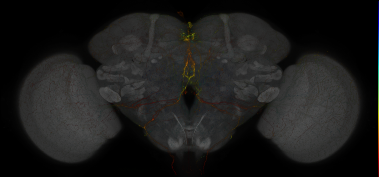 JRC_MB013B_Brain_2020__1