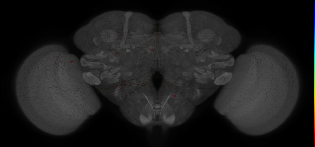 JRC_MB013B_Brain_2020__5