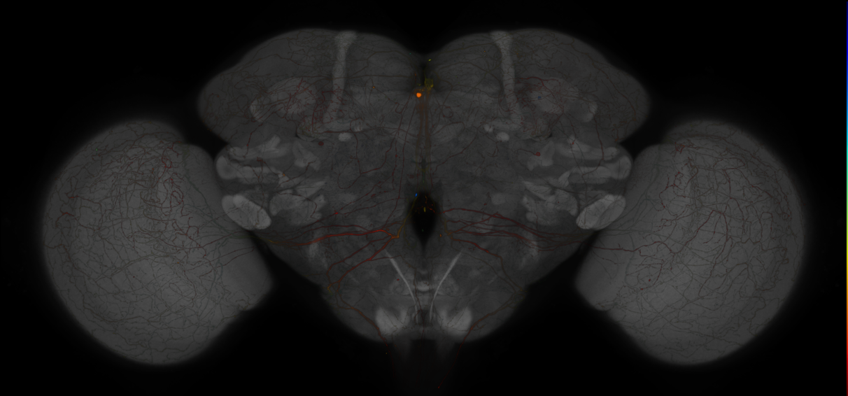 JRC_MB013B_Brain_2020__7
