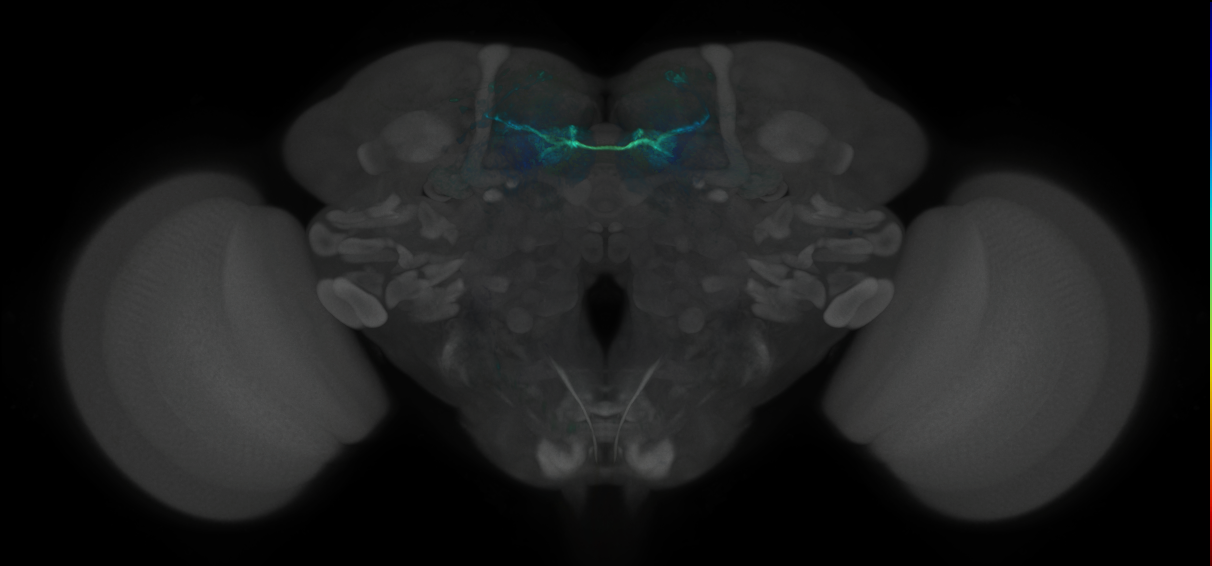 JRC_MB042B_Brain_2020__14