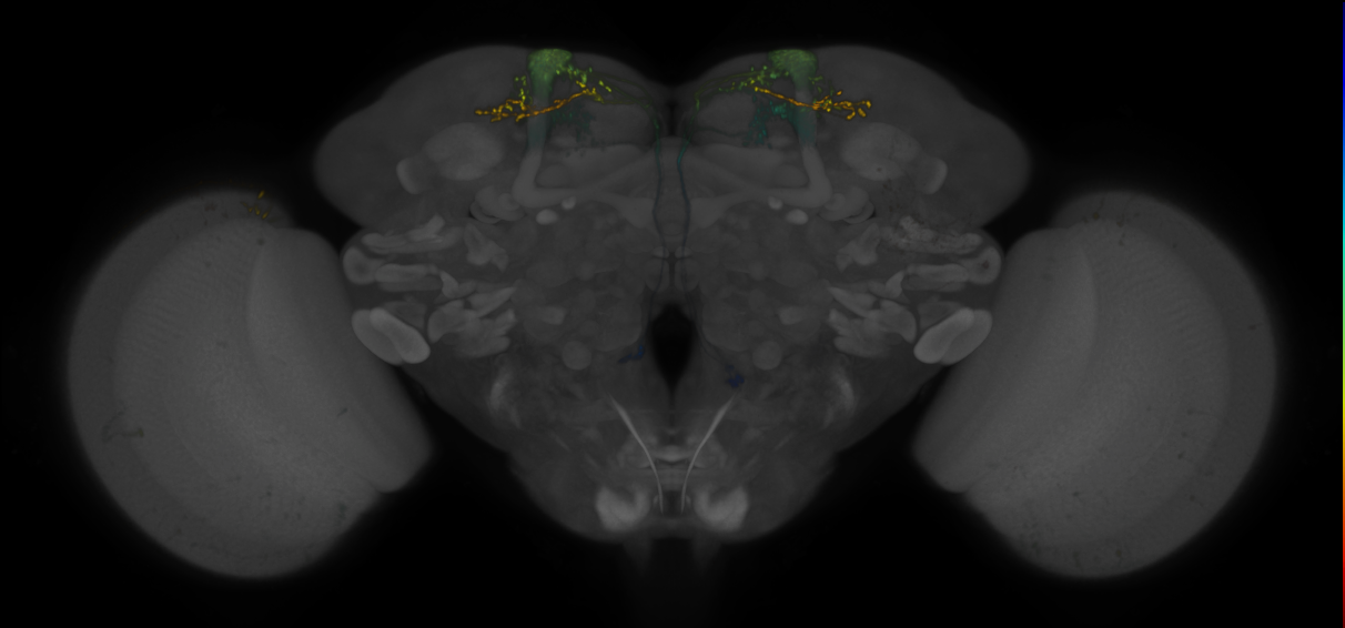JRC_MB082C_Brain_2020__11