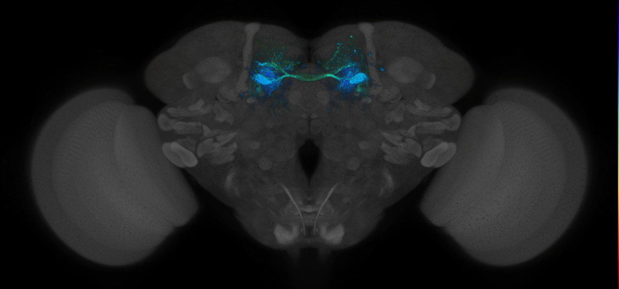 JRC_MB188B_Brain_2020__10