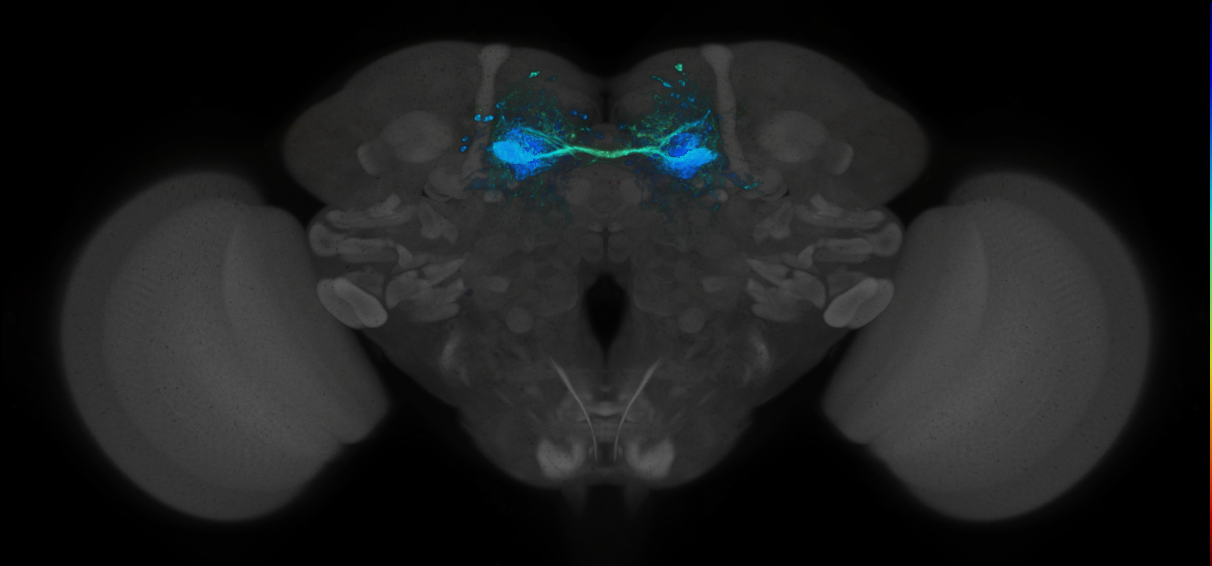 JRC_MB188B_Brain_2020__11