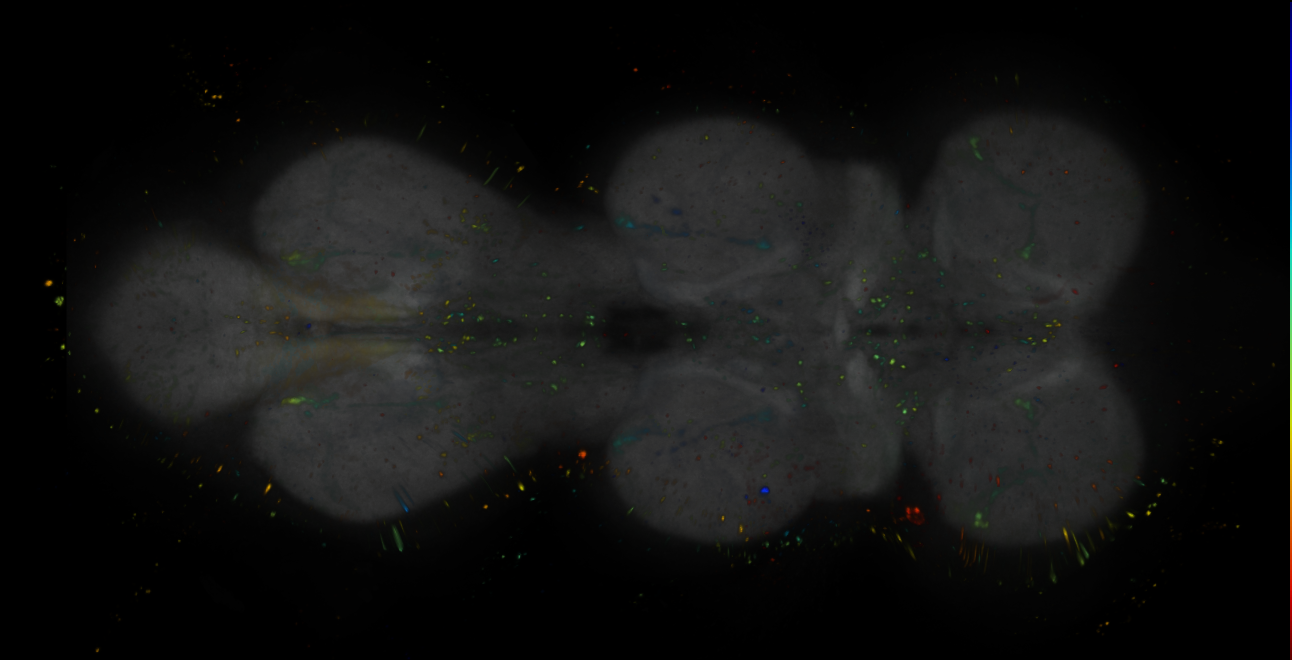 P{R13B05-GAL4.DBD} ∩ P{R14H09-p65.AD} expression pattern