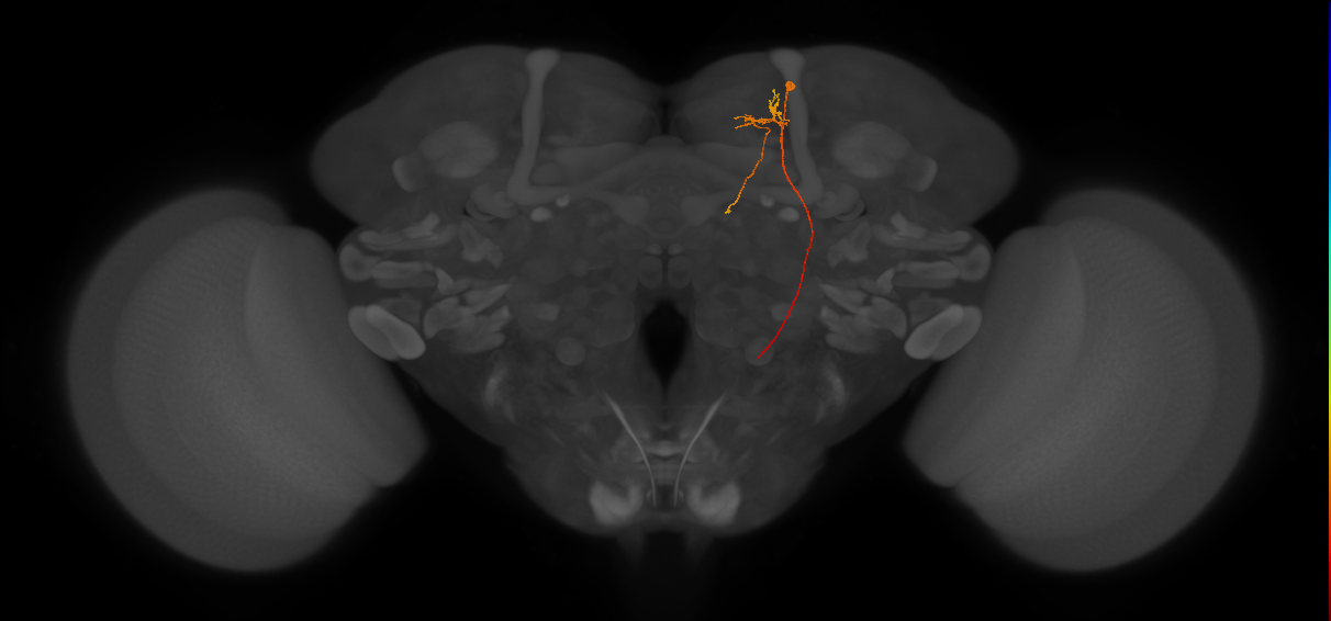 DNES1_R (FlyEM-HB:574834955)