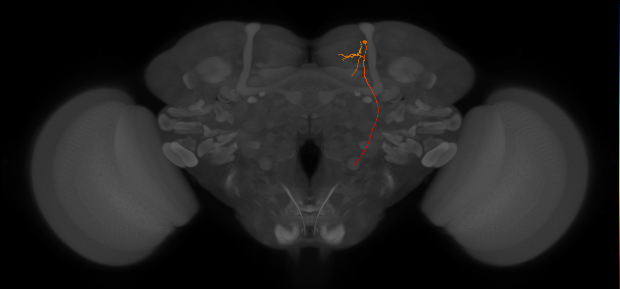 DNES1_R (FlyEM-HB:603478303)