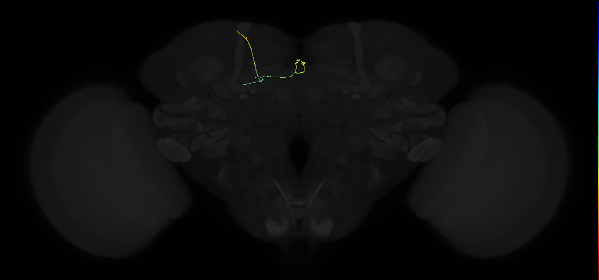 adult dorsal fan-shaped body tangential neuron