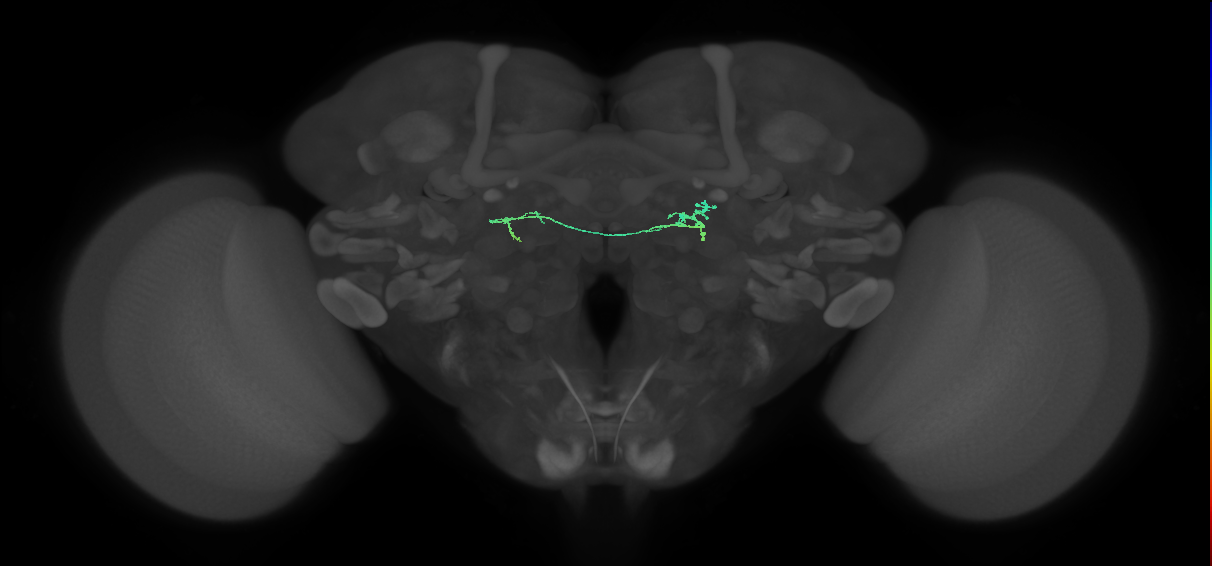 LAL086(AVM09)_L (FlyEM-HB:1510648988)