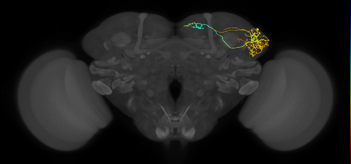 LHAD1b2_b_R (FlyEM-HB:573683438)