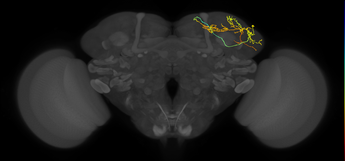LHAD1b5_R (FlyEM-HB:5901195496)