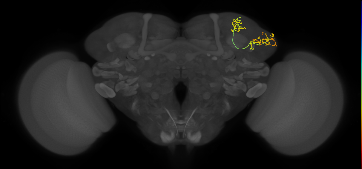 LHAD1f1_R (FlyEM-HB:420956213)