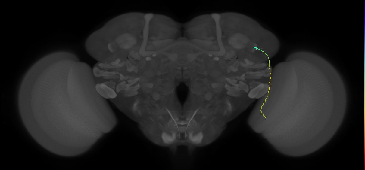 MC61 (FlyEM-HB:1200519445)