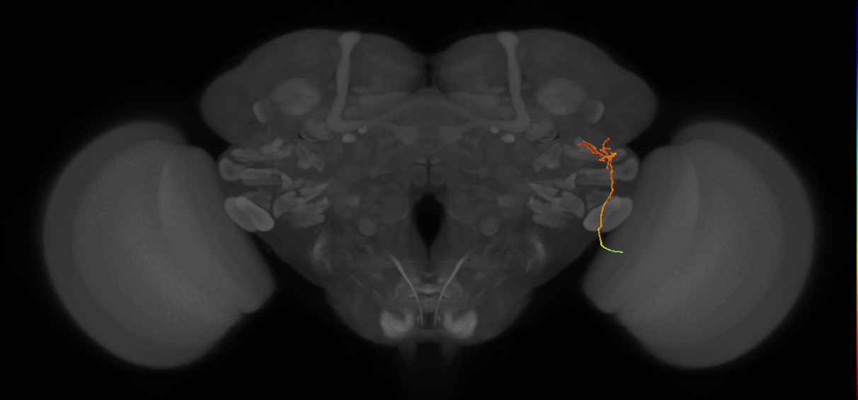 MC62(LWF5)_R (FlyEM-HB:1159948125)