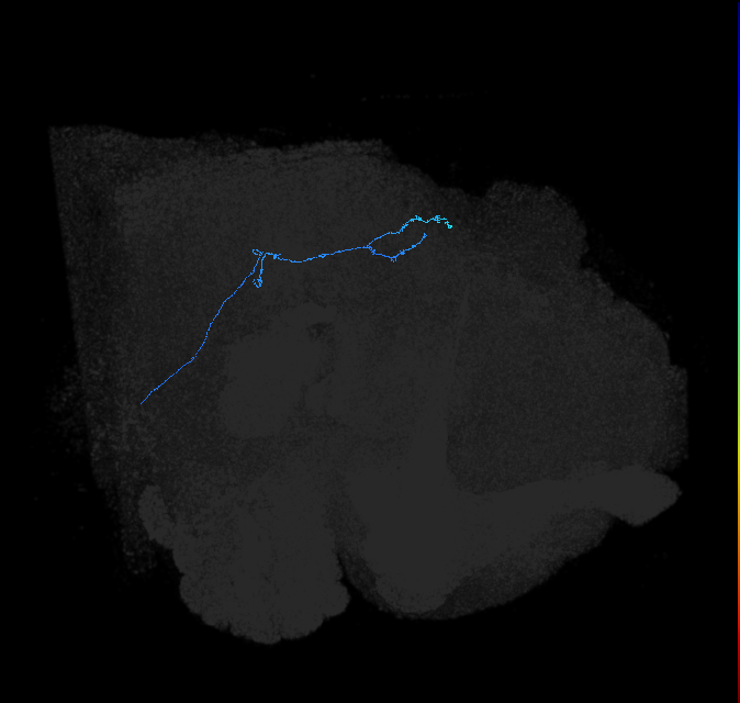 MC62 (FlyEM-HB:5813014910)