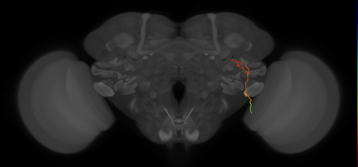 MC62 (FlyEM-HB:5813014910)