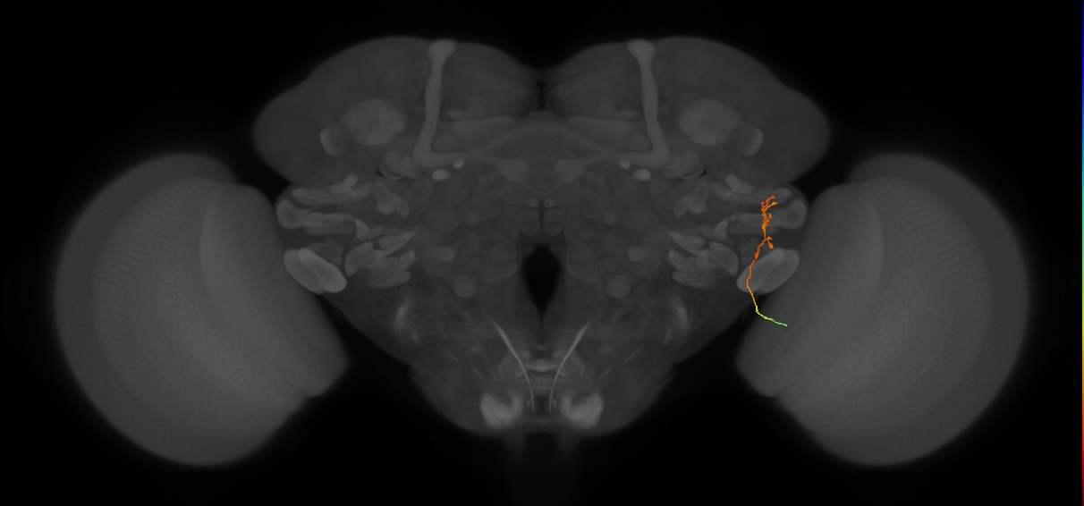 MC62(LWF5)_R (FlyEM-HB:1873091171)