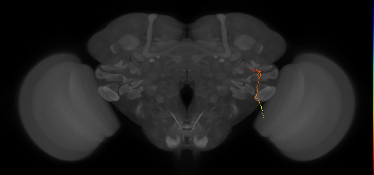MC62(LWF5)_R (FlyEM-HB:1313115622)