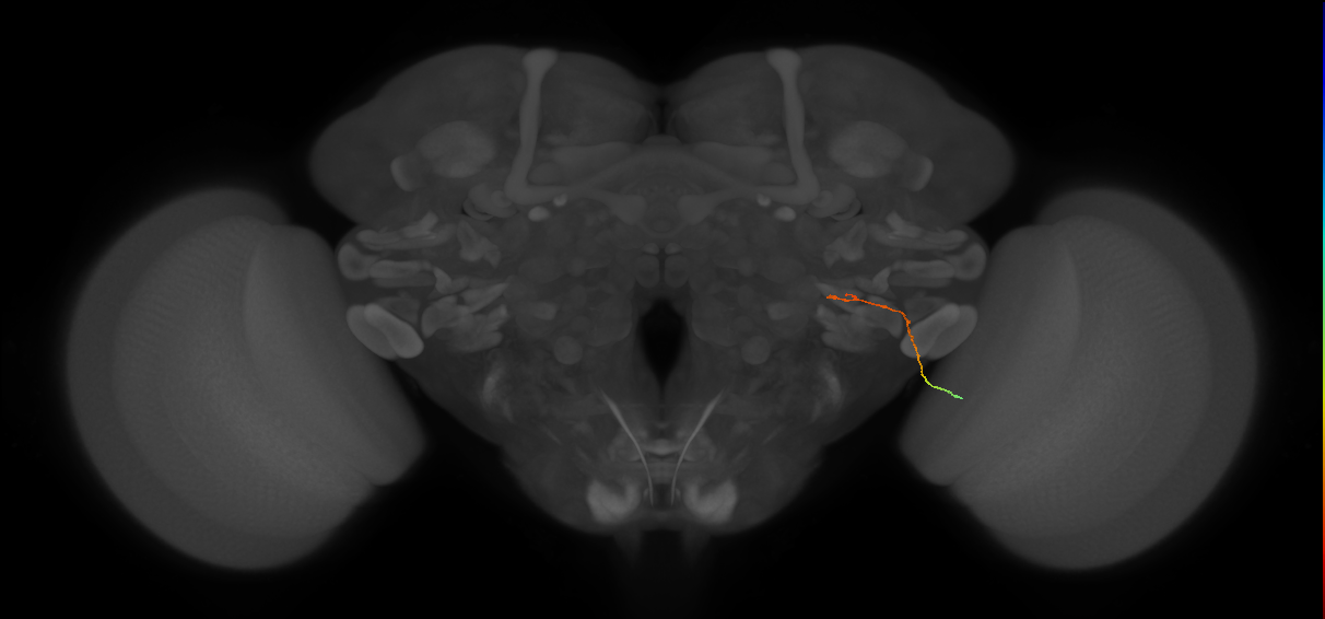 MC62(LWF5)_R (FlyEM-HB:1685892497)