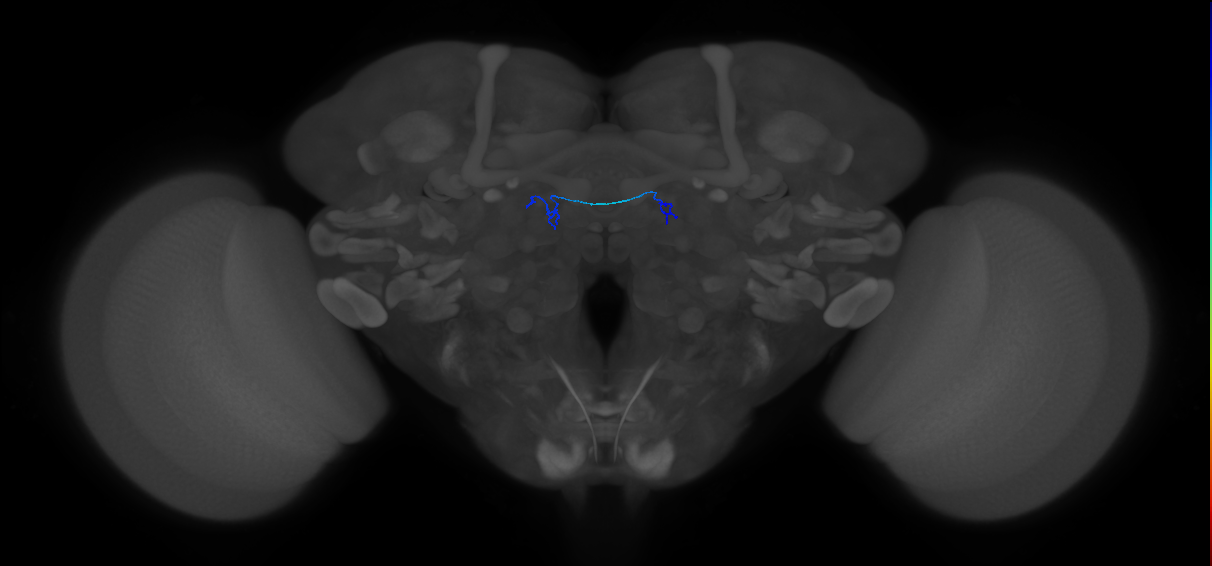ORN_DA2 (FlyEM-HB:1670390647)