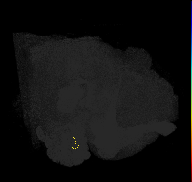 ORN_DM2 (FlyEM-HB:1826169618)