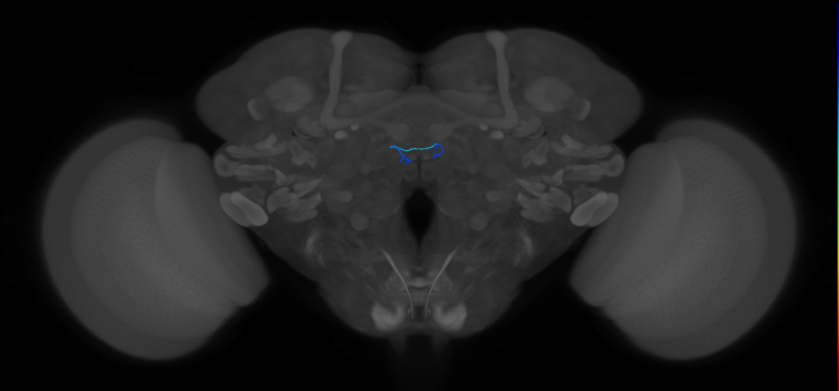 ORN_DM5 (FlyEM-HB:1794175616)