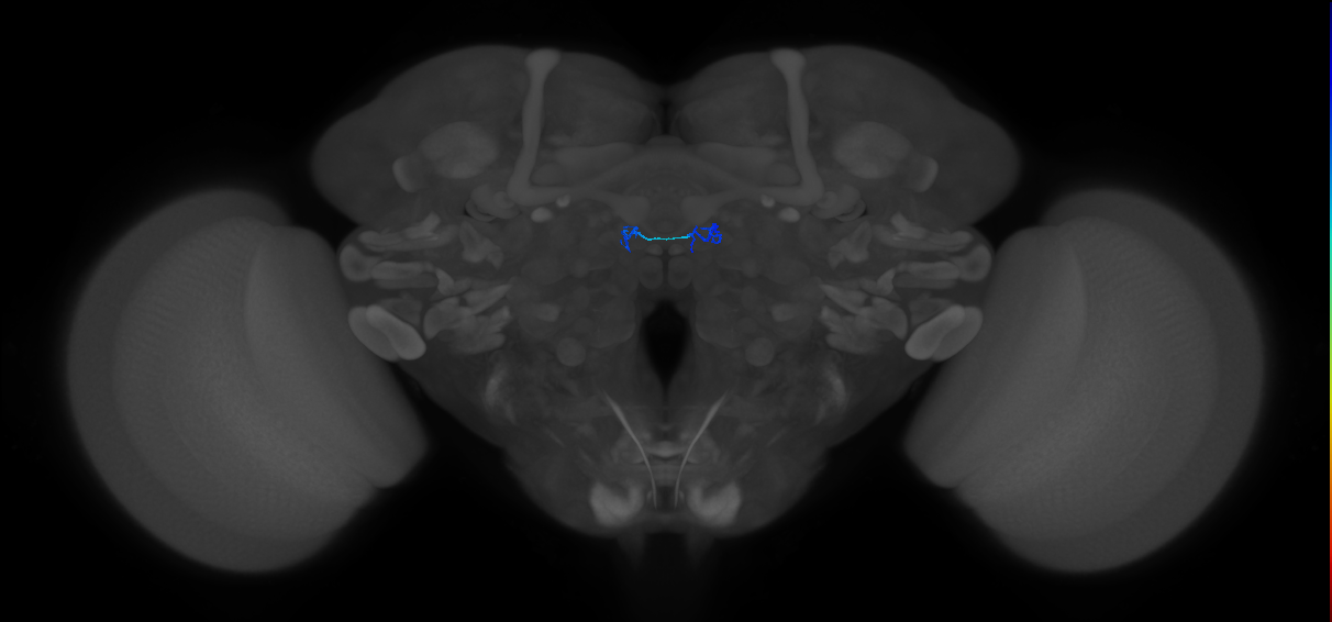 ORN_DM6_R (FlyEM-HB:1795484390)